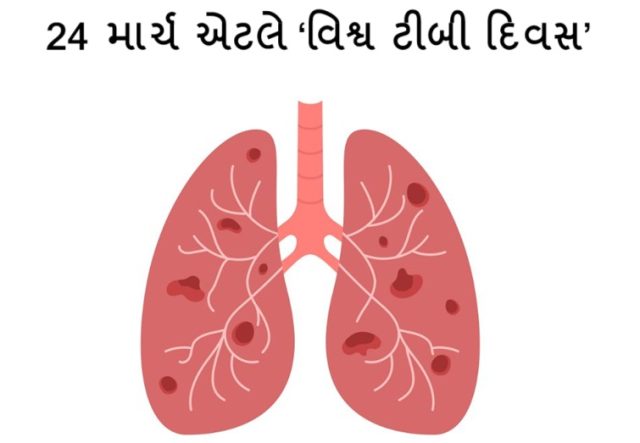 આજે 24 માર્ચ એટલે ‘વિશ્વ ટીબી દિવસ’